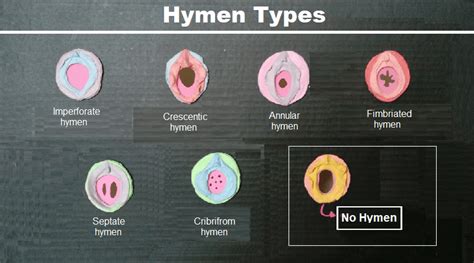 What Is the Hymen: Anatomy, Functions, Types and Care